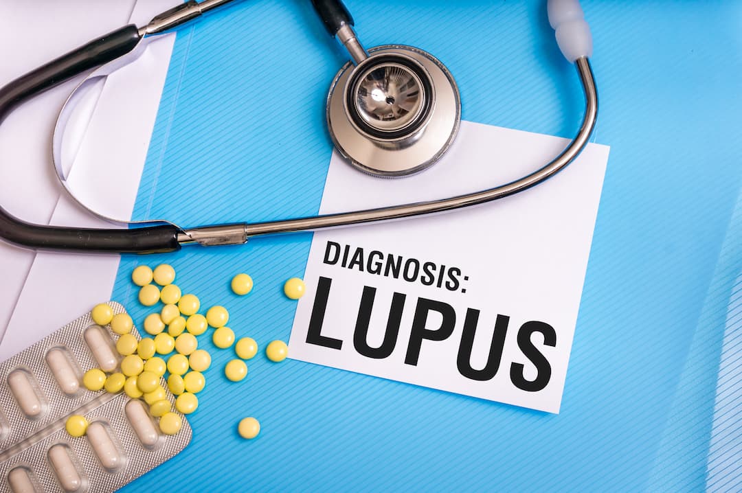 is lupus a disability