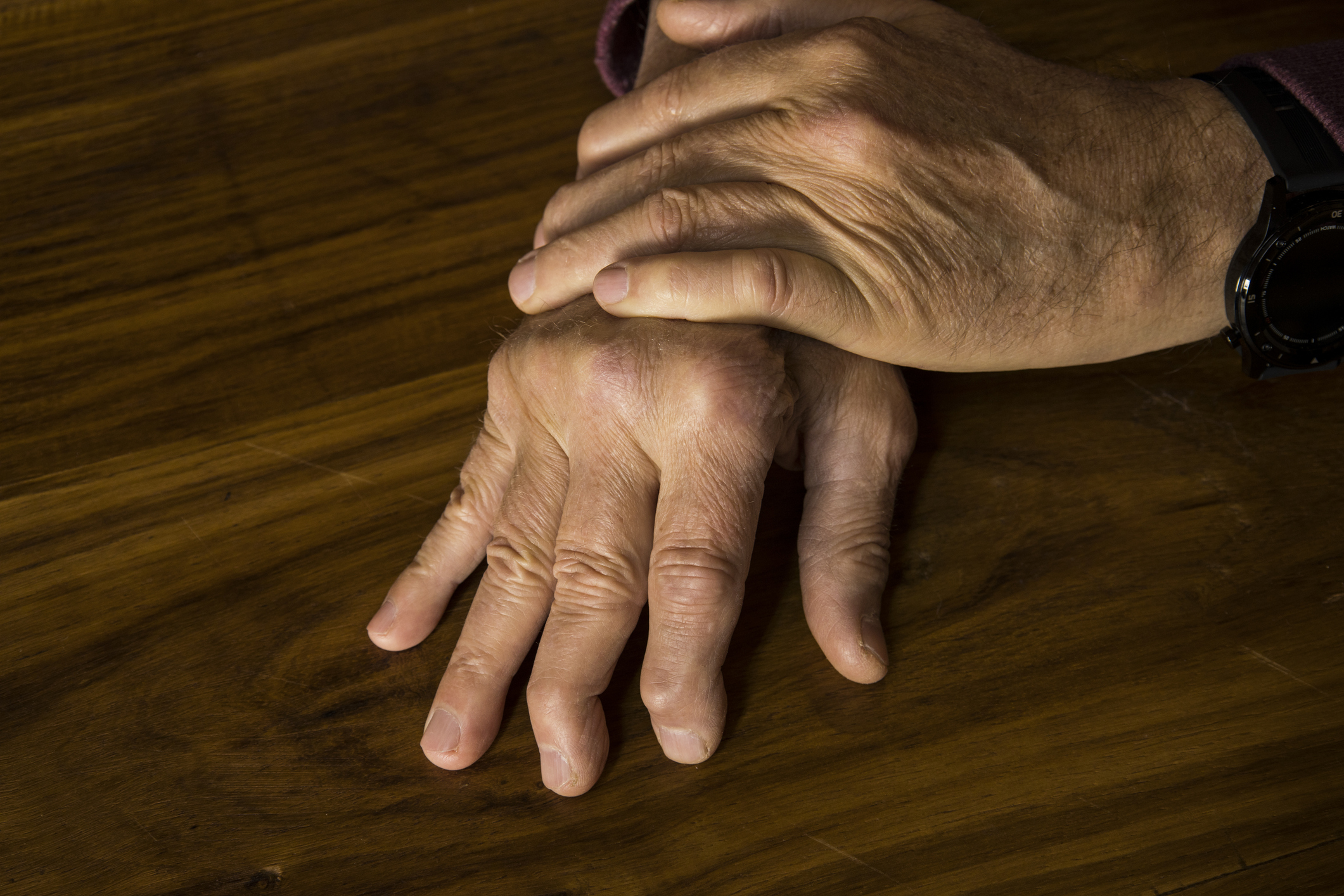 psoriatic arthritis