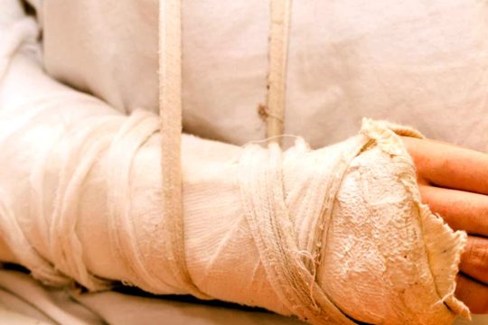 West Palm Beach Personal Injury Lawyer