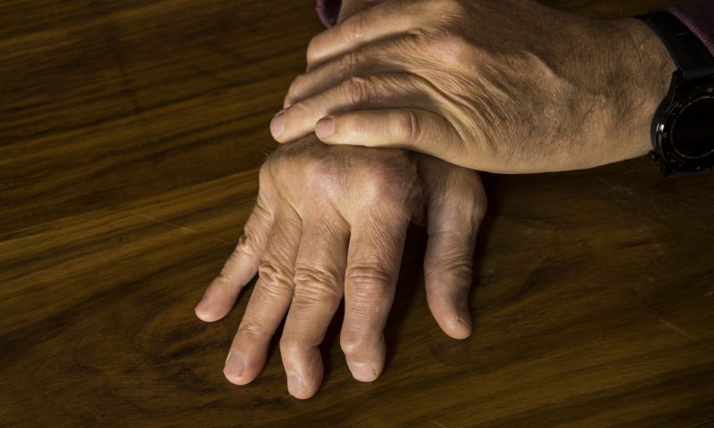 psoriatic arthritis