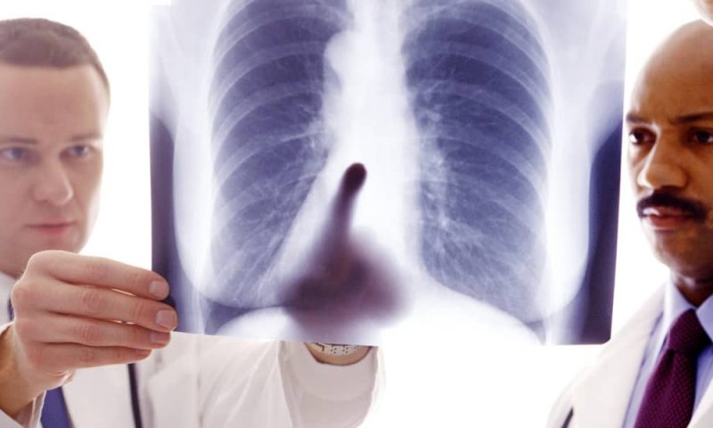 Scleroderma Complications | Federal Disability Insurance | LaBovick Law Group of Florida